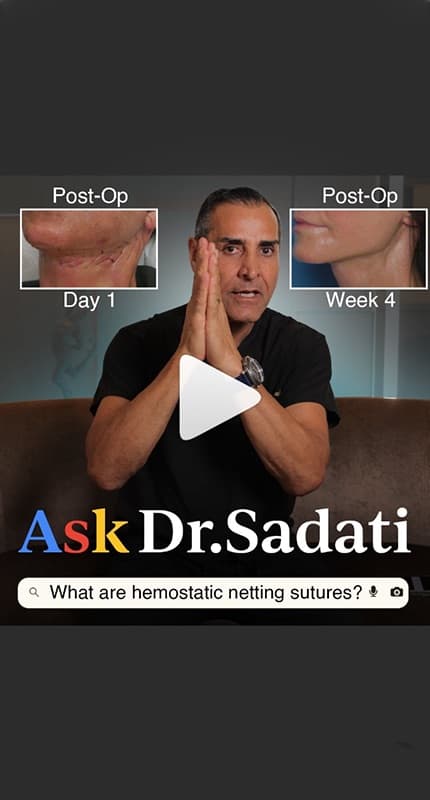 10 Things to Know Before Getting a Facelift: Dr. Kevin Sadati’s Expert Guide